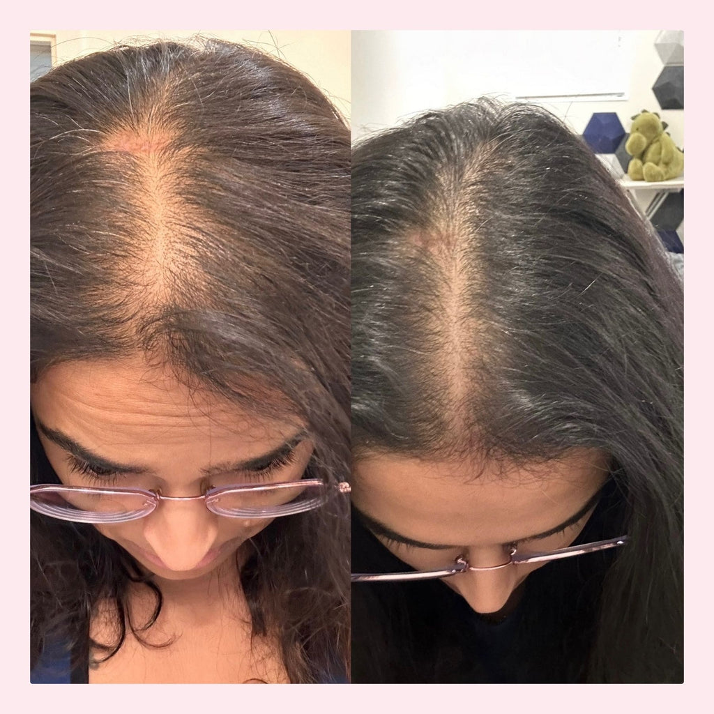 Luvia™ — Hair, Skin & Nails